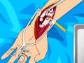 Игри Arm surgery 2