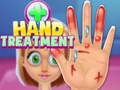 Игри Hand Treatment