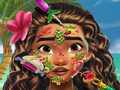 Игри Moana Skin Doctor